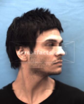 Anthony Rene Trevino
