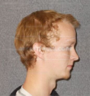 Vince L Anderson