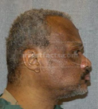 Lawrence Griffin