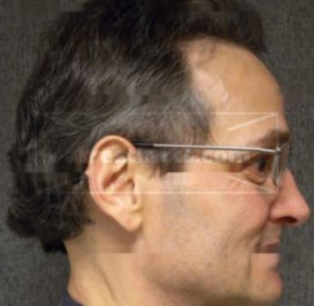 Stephen L Strehlow