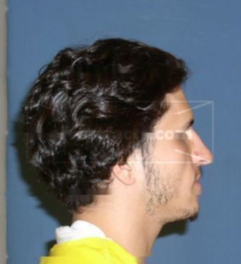Fabio A Bonaccorso