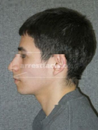 Armando Serrna