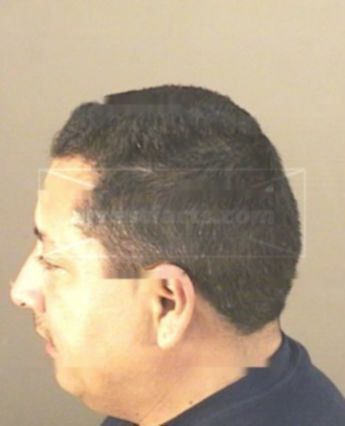 Martin Trevino