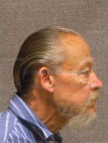 Lawrence J Woitkevich