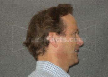 Jeffrey L Elverman