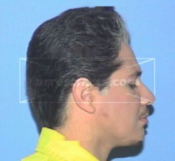 Trinidad Botello