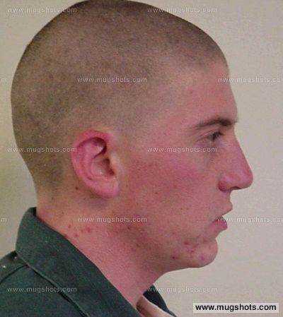 Ryan R Dobbertin