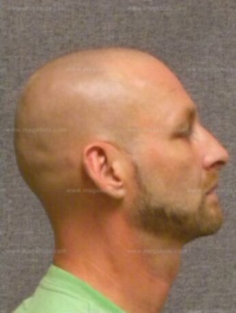 Duane A Gutzmer