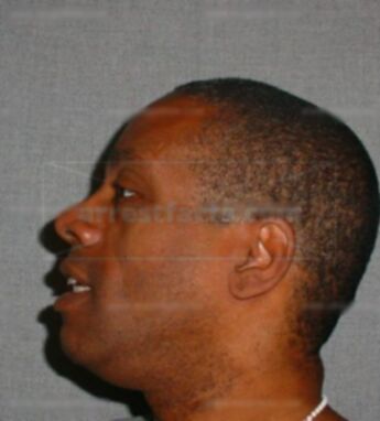 Deland A Dennis