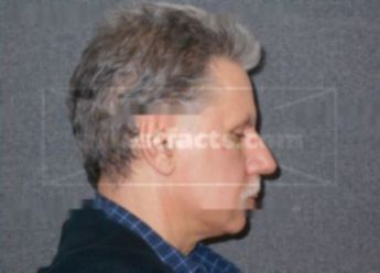 Glenn J Dlugi