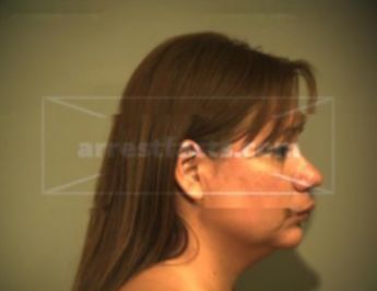 Melissa Herrera Garza