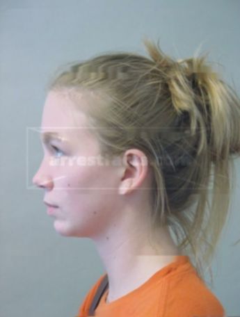 Lindsay M Ladwig
