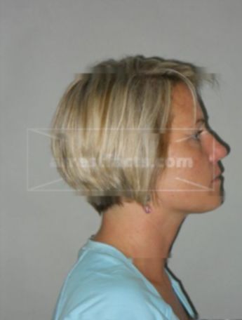 Angela S Collas