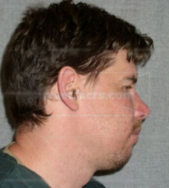 Jason J Lacanne