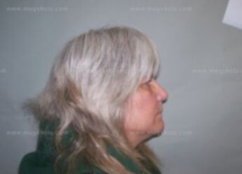 Barbara J Radke
