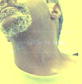 Joe Willie Hargrove