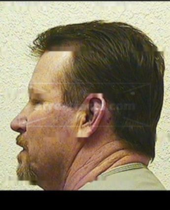 Charles W Mccollough