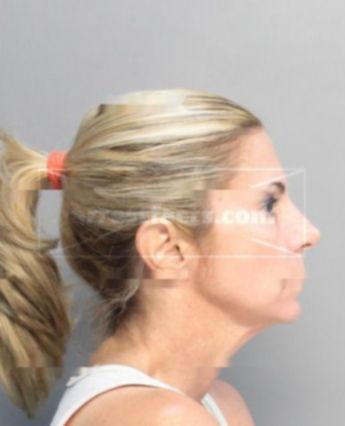 Brandy Rachel Nusbaum