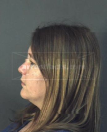 Stacy Tilton
