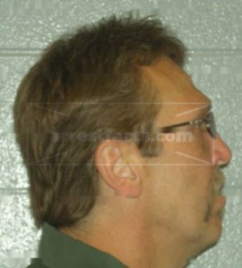 Randy L Behnke