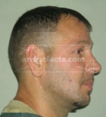 Rodney J Rader