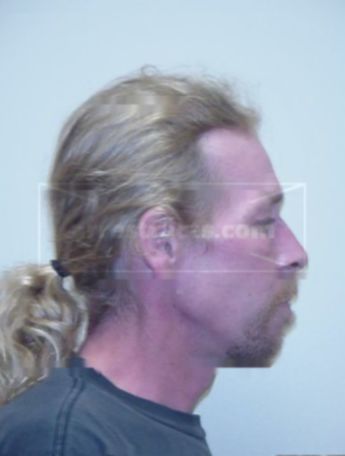 Todd L Mueller