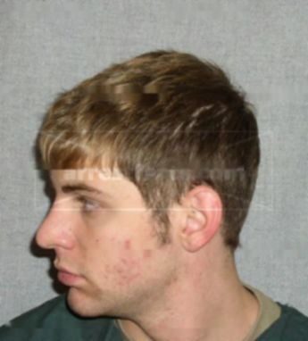 Austin R Pederson