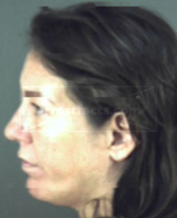 Terri Lynn Stueve