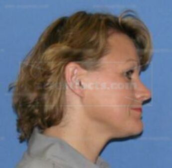 Nicola A Damron
