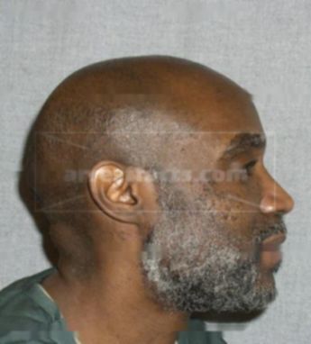 Bruce L Mcintosh