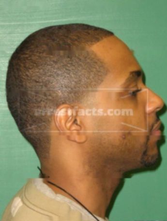 Earnest Jackson