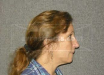 Sherrie L Lietz