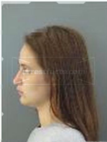 Nicole Renee Hall