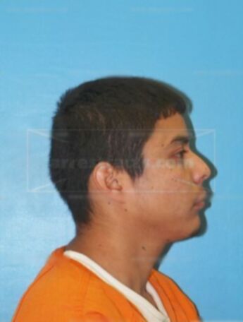 Andres Gonzalez-Gonzalez
