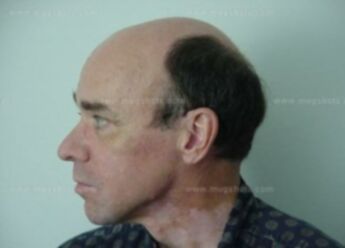 Marvin E Heikkila
