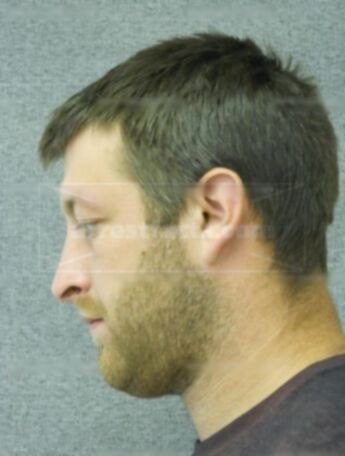 Allen M Dixon