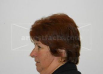 Susan L Nytes