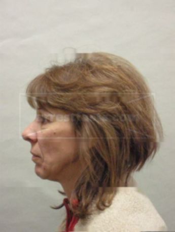 Brenda L Rybarczyk