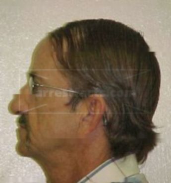 David W Phillips