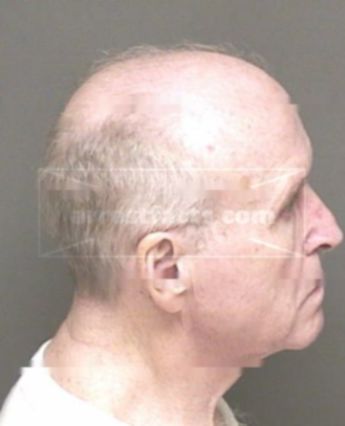 Albert Lester Davisson