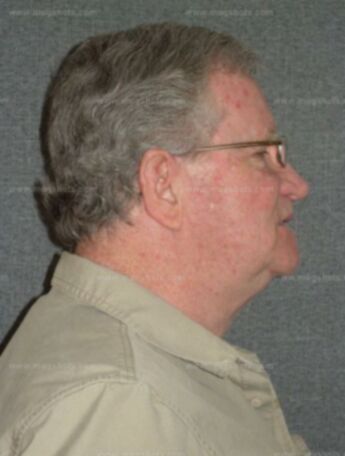 Glen R Collins