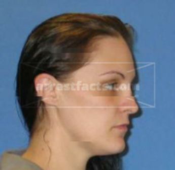 Amber L Lescher