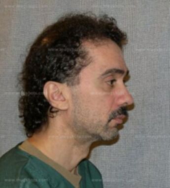 Benito Colon