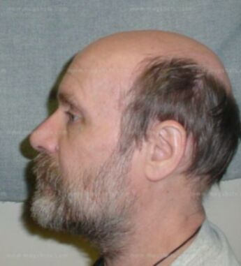 James D Lammers