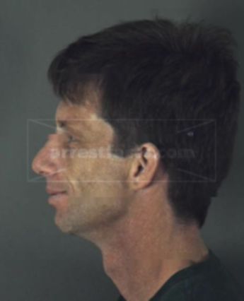 Carlin Spencer Mcalister Iv