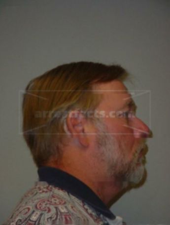 Gary A Michels
