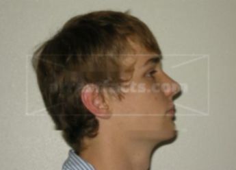 Devin K Kolpack