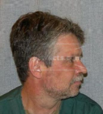 Theodore Denormandie