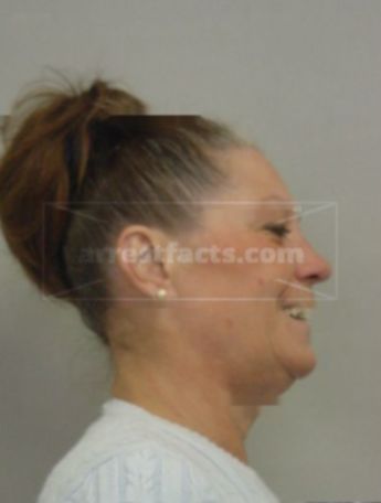 Patricia D Jens