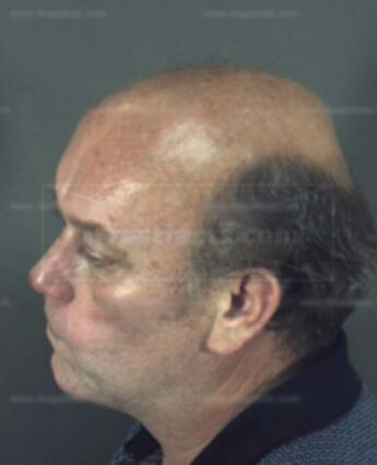 Gordon Leroy Biggs
